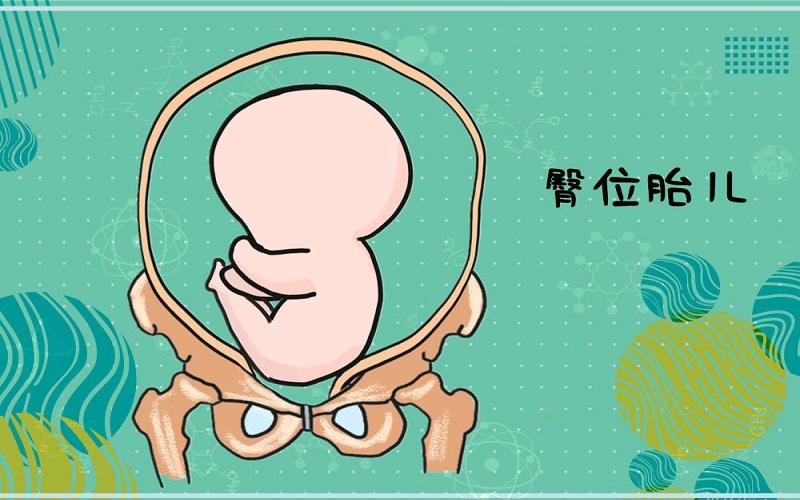 胎儿头部偏大的原因有三点,四种应对措施附在文章结尾
