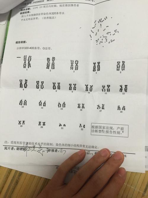 羊水穿刺染色体报告解读:是男孩还是女孩一目了然!